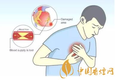 吸煙的兩大主要危害 拒絕健康被煙沒(méi)!