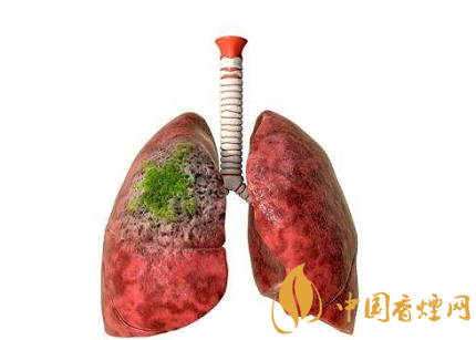 遠離二手煙 健康就能少7種威脅